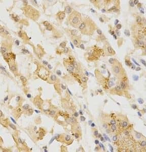 Immunohistochemistry GGA2 Antibody - BSA Free