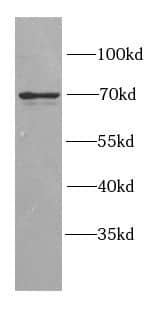Western Blot GGA2 Antibody - BSA Free
