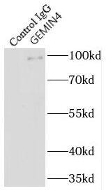 Immunoprecipitation: Gemin 4 Antibody - BSA Free [NBP3-46242] - IP result of anti-Gemin 4 ( for IP and Detection) with 293 cell lysate.