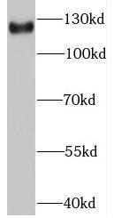 Western Blot: Gemin 4 Antibody - BSA Free [NBP3-46242] - HEK-293 cells were subjected to SDS PAGE followed by western blot with (Gemin 4 antibody) at dilution of 1:100