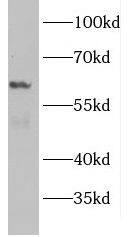 Western Blot: MIR16 Antibody - BSA Free [NBP3-46244] - PC-3 cells were subjected to SDS PAGE followed by western blot with (MIR16 antibody) at dilution of 1:500