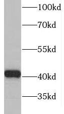 Western Blot: GDAP1L1 Antibody - BSA Free [NBP3-46246] - Y79 cells were subjected to SDS PAGE followed by western blot with (GDAP1L1 antibody) at dilution of 1:400