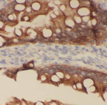 Immunohistochemistry: GCS1 Antibody - BSA Free [NBP3-46248] - Immunohistochemistry of paraffin-embedded human small intestine using (GCS1 antibody) at dilution of 1:100