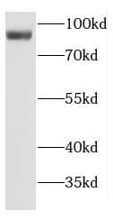 Western Blot: GCS1 Antibody - BSA Free [NBP3-46248] - Mouse brain tissue were subjected to SDS PAGE followed by western blot with (GCS1 antibody) at dilution of 1:500