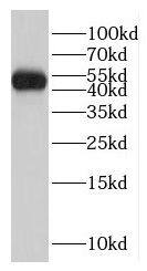 Western Blot GCM2 Antibody - BSA Free