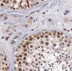 Immunohistochemistry: GBP6 Antibody - BSA Free [NBP3-46254] - Immunohistochemistry of paraffin-embedded human testis tissue slide using (GBP6 Antibody) at dilution of 1:50