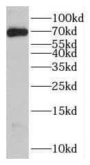 Western Blot: GBP6 Antibody - BSA Free [NBP3-46254] - HeLa cells were subjected to SDS PAGE followed by western blot with (GBP6 Antibody) at dilution of 1:300