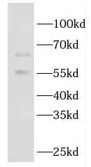 Western Blot GBP5 Antibody - BSA Free