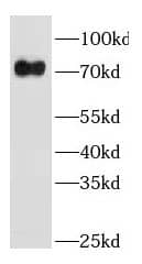 Western Blot: GBP4 Antibody - BSA Free [NBP3-46256] - Human placenta tissue were subjected to SDS PAGE followed by western blot with (GBP4 antibody) at dilution of 1:600
