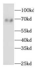 Western Blot: p66 beta Antibody - BSA Free [NBP3-46260] - A549 cells were subjected to SDS PAGE followed by western blot with ( p66 beta Antibody) at dilution of 1:1000