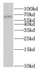 Western Blot: GAS8 Antibody - BSA Free [NBP3-46261] - NIH/3T3 cells were subjected to SDS PAGE followed by western blot with (GAS8 antibody) at dilution of 1:500
