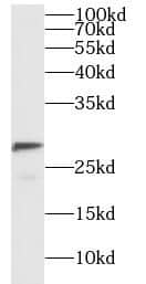 Western Blot: NOLA1 Antibody - BSA Free [NBP3-46262] - A375 cells were subjected to SDS PAGE followed by western blot with (NOLA1 antibody) at dilution of 1:500