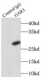 Immunoprecipitation: NOLA1 Antibody - BSA Free [NBP3-46262] - IP Result of anti-NOLA1 (IP: , 3ug; Detection:  1:500) with A375 cells lysate 3000ug.