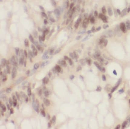 Immunohistochemistry MCM3AP Antibody - BSA Free
