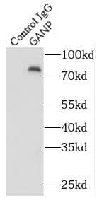 Immunoprecipitation MCM3AP Antibody - BSA Free