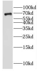 Western Blot GALNT9 Antibody - BSA Free