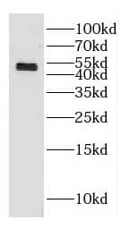 Western Blot GAL3ST3 Antibody - BSA Free