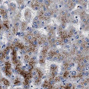 Immunohistochemistry: G6PC3 Antibody - BSA Free [NBP3-46280] - Immunohistochemistry of paraffin-embedded human liver tissue slide using ( G6PC3 Antibody) at dilution of 1:200