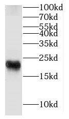 Western Blot: FXYD7 Antibody - BSA Free [NBP3-46282] - Mouse brain tissue were subjected to SDS PAGE followed by western blot with (FXYD7 antibody) at dilution of 1:600