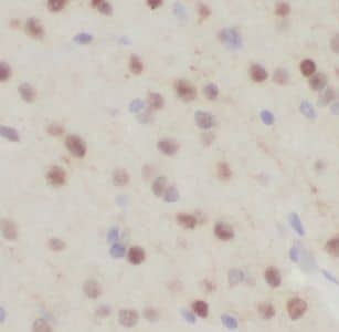 Immunohistochemistry: FXYD6 Antibody - BSA Free [NBP3-46283] - Immunohistochemistry of paraffin-embedded human brain using (FXYD6 antibody) at dilution of 1:100