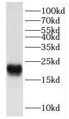Western Blot: FXYD6 Antibody - BSA Free [NBP3-46283] - Human brain tissue were subjected to SDS PAGE followed by western blot with (FXYD6 antibody) at dilution of 1:400