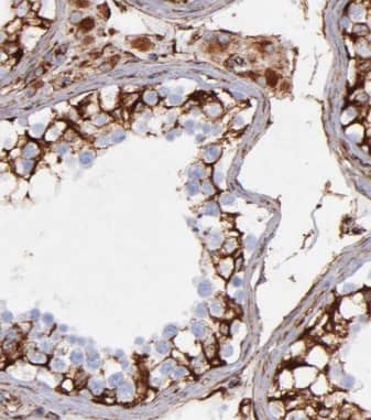 Immunohistochemistry: FXYD4 Antibody - BSA Free [NBP3-46284] - Immunohistochemistry of paraffin-embedded mouse testis tissue slide using (FXYD4 Antibody) at dilution of 1:50
