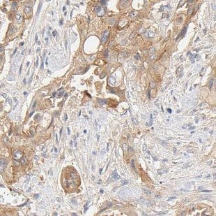 Immunohistochemistry FXYD2 Antibody - BSA Free
