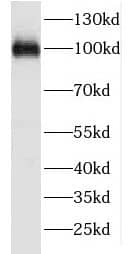 Western Blot FSD2 Antibody - BSA Free