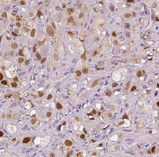 Immunohistochemistry FSCN3 Antibody - BSA Free