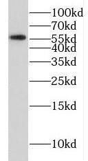 Western Blot FSCN3 Antibody - BSA Free