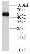 Western Blot: FRS3 Antibody - BSA Free [NBP3-46295] - Human placenta tissue were subjected to SDS PAGE followed by western blot with (FRS3 antibody) at dilution of 1:500