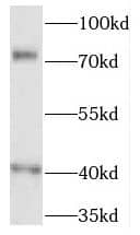 Western Blot: QBRICK/FREM1 Antibody - BSA Free [NBP3-46296] - Human plasma tissue were subjected to SDS PAGE followed by western blot with (QBRICK/FREM1 Antibody) at dilution of 1:300