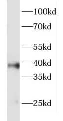 Western Blot: FOXR2 Antibody - BSA Free [NBP3-46301] - SH-SY5Y cells were subjected to SDS PAGE followed by western blot with ( FOXR2 Antibody) at dilution of 1:300