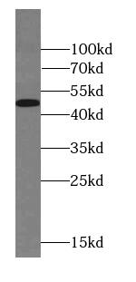 Western Blot: FOXD4L6 Antibody - BSA Free [NBP3-46304] - A431 cells were subjected to SDS PAGE followed by western blot with (FOXD4L6 antibody) at dilution of 1:1000