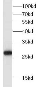 Western Blot: FKBP14 Antibody - BSA Free [NBP3-46313] - HEK-293 cells were subjected to SDS PAGE followed by western blot with (FKBP14 antibody) at dilution of 1:500