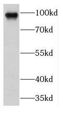 Western Blot: Filensin Antibody - BSA Free [NBP3-46315] - HepG2 cells were subjected to SDS PAGE followed by western blot with (Filensin antibody) at dilution of 1:500