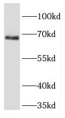 Western Blot: FIGNL1 Antibody - BSA Free [NBP3-46316] - HeLa cells were subjected to SDS PAGE followed by western blot with (FIGNL1 antibody) at dilution of 1:1500