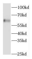Western Blot: FGFBP3 Antibody - BSA Free [NBP3-46323] - Human testis tissue were subjected to SDS PAGE followed by western blot with (FGFBP3 Antibody) at dilution of 1:300