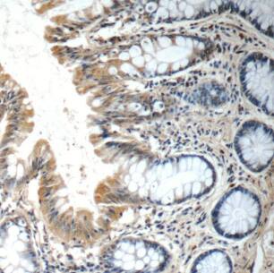 Immunohistochemistry: FGFBP3 Antibody - BSA Free [NBP3-46323] - Immunohistochemistry of paraffin-embedded human colon tissue slide using (FGFBP3 Antibody) at dilution of 1:50