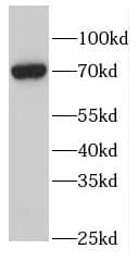 Western Blot: FEM1B Antibody - BSA Free [NBP3-46324] - Jurkat cells were subjected to SDS PAGE followed by western blot with (FEM1B antibody) at dilution of 1:1000