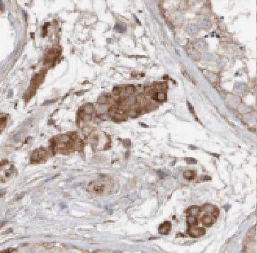 Immunohistochemistry: FDXACB1 Antibody - BSA Free [NBP3-46326] - Immunohistochemistry of paraffin-embedded human testis tissue slide using (FDXACB1 Antibody) at dilution of 1:50