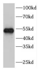 Western Blot: FBXW2 Antibody - BSA Free [NBP3-46329] - HEK-293 cells were subjected to SDS PAGE followed by western blot with (FBXW2 Antibody) at dilution of 1:600