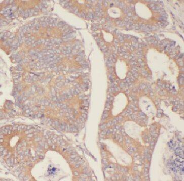 Immunohistochemistry FBXW2 Antibody - BSA Free