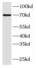 Western Blot: F-box protein 43 Antibody - BSA Free [NBP3-46332] - HEK-293 cells were subjected to SDS PAGE followed by western blot with ( F-box protein 43 Antibody) at dilution of 1:300