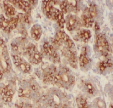 Immunohistochemistry: FBXO22 Antibody - BSA Free [NBP3-46335] - Immunohistochemistry of paraffin-embedded human tonsil using (FBXO22 antibody) at dilution of 1:50