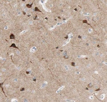 Immunohistochemistry FBXO2 Antibody - BSA Free