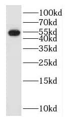 Western Blot: FBXL16 Antibody - BSA Free [NBP3-46340] - HeLa cells were subjected to SDS PAGE followed by western blot with ( FBXL16 Antibody) at dilution of 1:600
