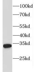 Western Blot: FBXL15 Antibody - BSA Free [NBP3-46341] - MDA-MB-453s cells were subjected to SDS PAGE followed by western blot with ( FBXL15 Antibody) at dilution of 1:300