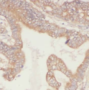 Immunohistochemistry FBF1 Antibody - BSA Free