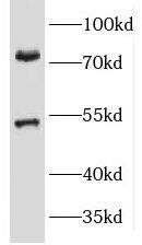 Western Blot: Kv1.3 Antibody - BSA Free [NBP3-46348] - A549 cells were subjected to SDS PAGE followed by western blot with (Kv1.3 antibody) at dilution of 1:1000